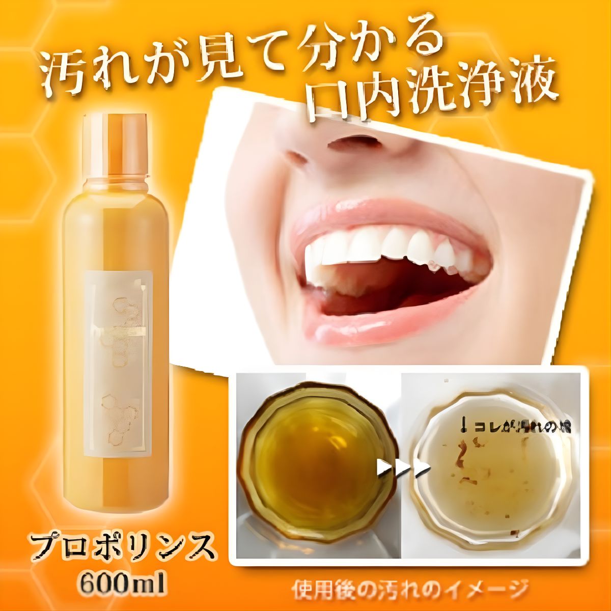Nước Súc Miệng Làm Sạch Mảng Bảm Propoline 600ML