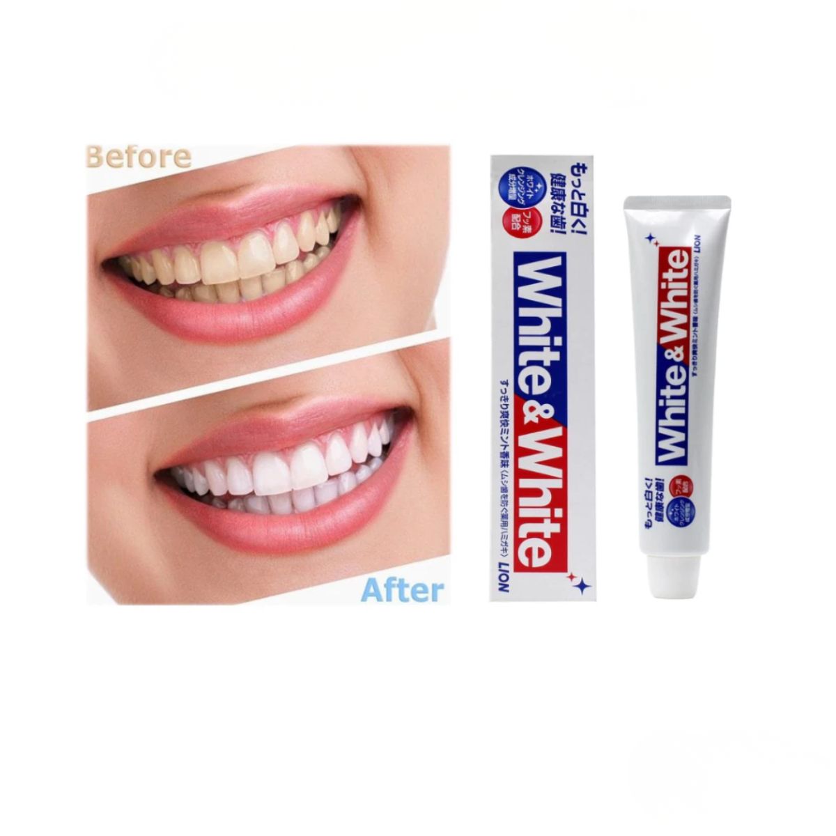 Kem Đánh Răng Trắng Răng White & White 150g | Làm Trắng & Bảo Vệ Răng Miệng
